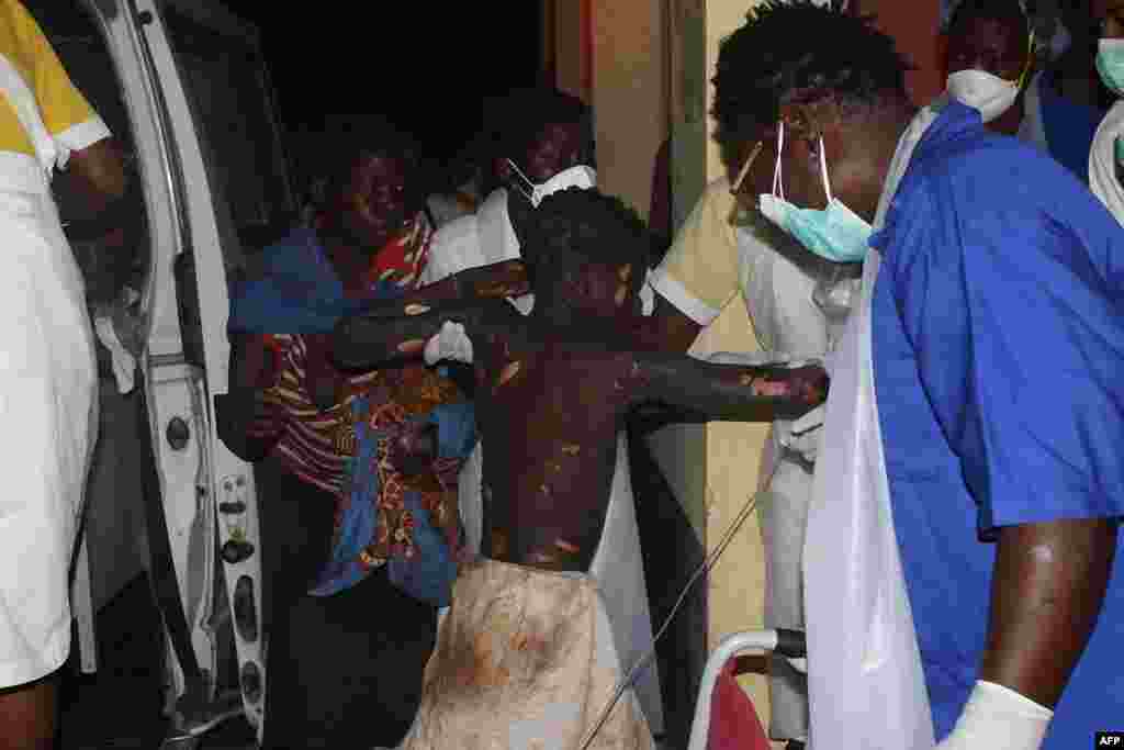 Un enfant gravement brûlé arrive à l&#39;hôpital provincial de Tete, au Mozambique, 17 novembre 2016.