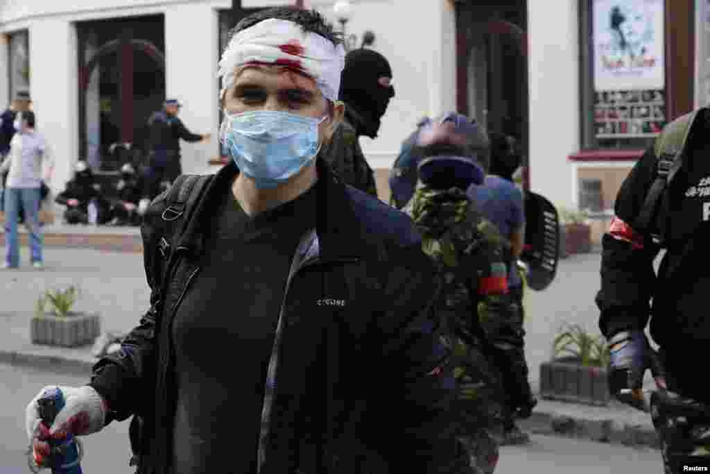 An injured pro-Russian activist looks on during clashes with supporters of the Kyiv government in the streets of Odessa, Ukriane, May 2, 2014. 