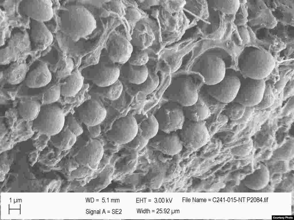 Naučnici sumnjaju da neke od bakterija razgrađuju ili pregrađuju plastiku. (Credit: E. Zettler, SEA Education Association)