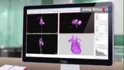 Mẫu chế tạo bằng máy in 3-D hỗ trợ cho việc mổ tim