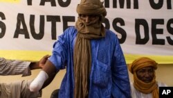 Alhader Ag Almahmoud, un berger touareg de 30 ans dont la main droite a été amputée par un groupe islamiste à Bamako, au Mali, le 20 septembre 2012. (Archives)