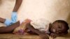 Research Reveals Huge Burden of Guinea Worm