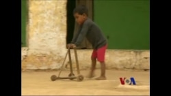 残疾儿童急需社会关注