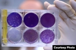 A researcher holds a tray of Zika virus growing in animal cells at Washington University School of Medicine in St. Louis, Missouri. Researchers have identified a human antibody that prevents, in pregnant mice, the fetus from becoming infected and the placenta from being damaged. The antibody also protects adult mice from Zika disease. (Photo courtesy of Huy Mach)