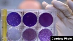 Virus zike analizira se na Medicinskom fakultetu univerziteta Vašington u Sent Luisu u Mizuriju.