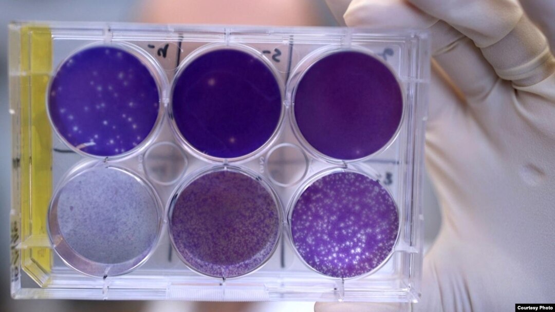 FILE - A researcher holds a tray of Zika virus growing in animal cells at Washington University School of Medicine in St. Louis, Missouri. 