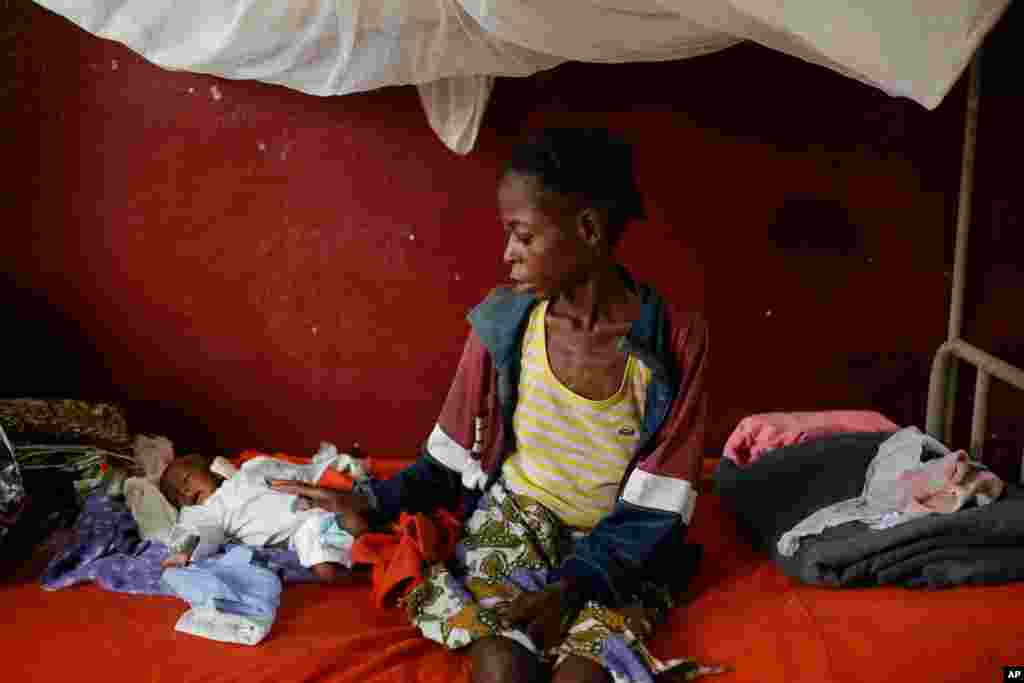 A severely malnourished child lays by his mother at a pediatric center in Bangui, Central African Republic,&nbsp;Dec. 17, 2013.