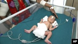 a Premature Baby in India has medical tape placed on her face. 