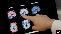 FILE - Dr. William Burke goes over a PET brain scan, Aug. 14, 2018, at Banner Alzheimers Institute in Phoenix, Arizona.