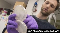 Research technician Henri Berger talks about live yeast cultures at New York Unversity Lab on April 25, 2017. The lab is one of 11 working to build redesigned yeast DNA from scratch. (AP Photo/Mary Altaffer)