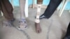 A patient at the International Committee of the Red Cross amputee center took the prosthetic leg of a deceased relative after years of waiting, Rumbek, South Sudan, February 2013. (H. McNeish/VOA)