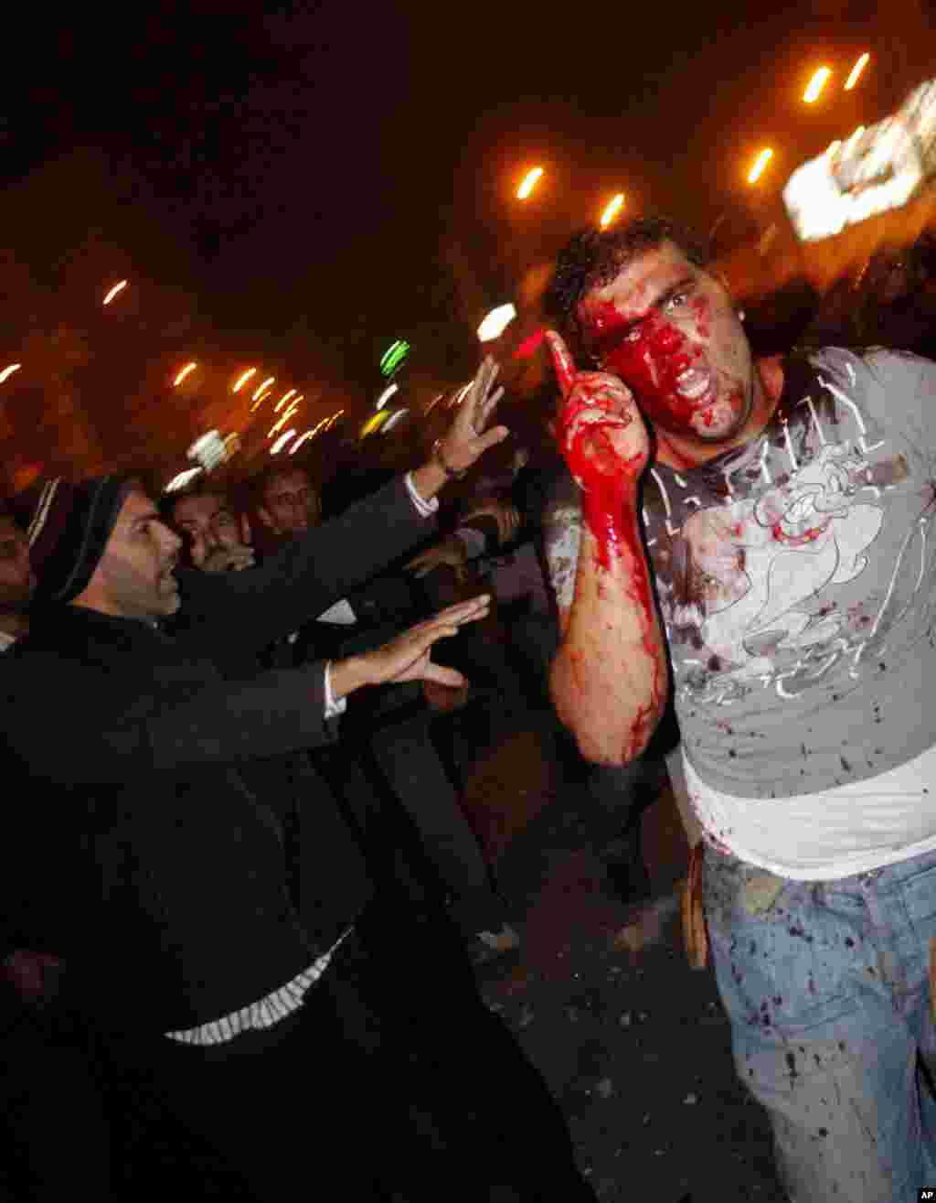 A wounded protester reacts during clashes between supporters and opponents of Egyptian President Mohammed Morsi outside the presidential palace in Cairo, Egypt, Wednesday, December 5.