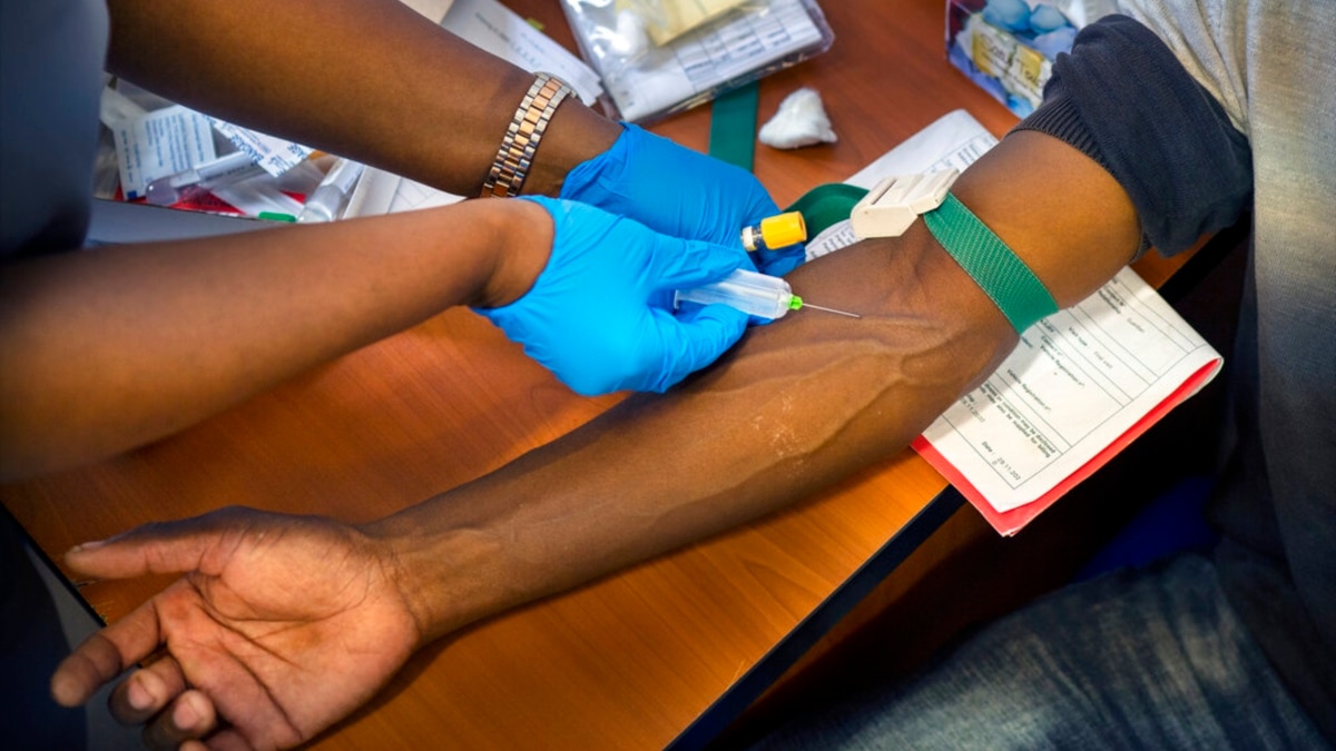 In Africa, Distrust of COVID-19 Vaccine Slows Prevention Efforts - Vimarsana News