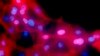 นักวิจัยพัฒนา 'อนุภาคนาโน' เรืองเเสงเมื่อพบเซลล์มะเร็ง