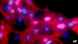 FILE - This undated fluorescence-colored microscope image made available by the National Institutes of Health in September 2016 shows a culture of human breast cancer cells. For the first time, one of the new immunotherapy drugs has shown promise against breast cancer in a large study that combined it with chemotherapy to treat an aggressive form of the disease. 