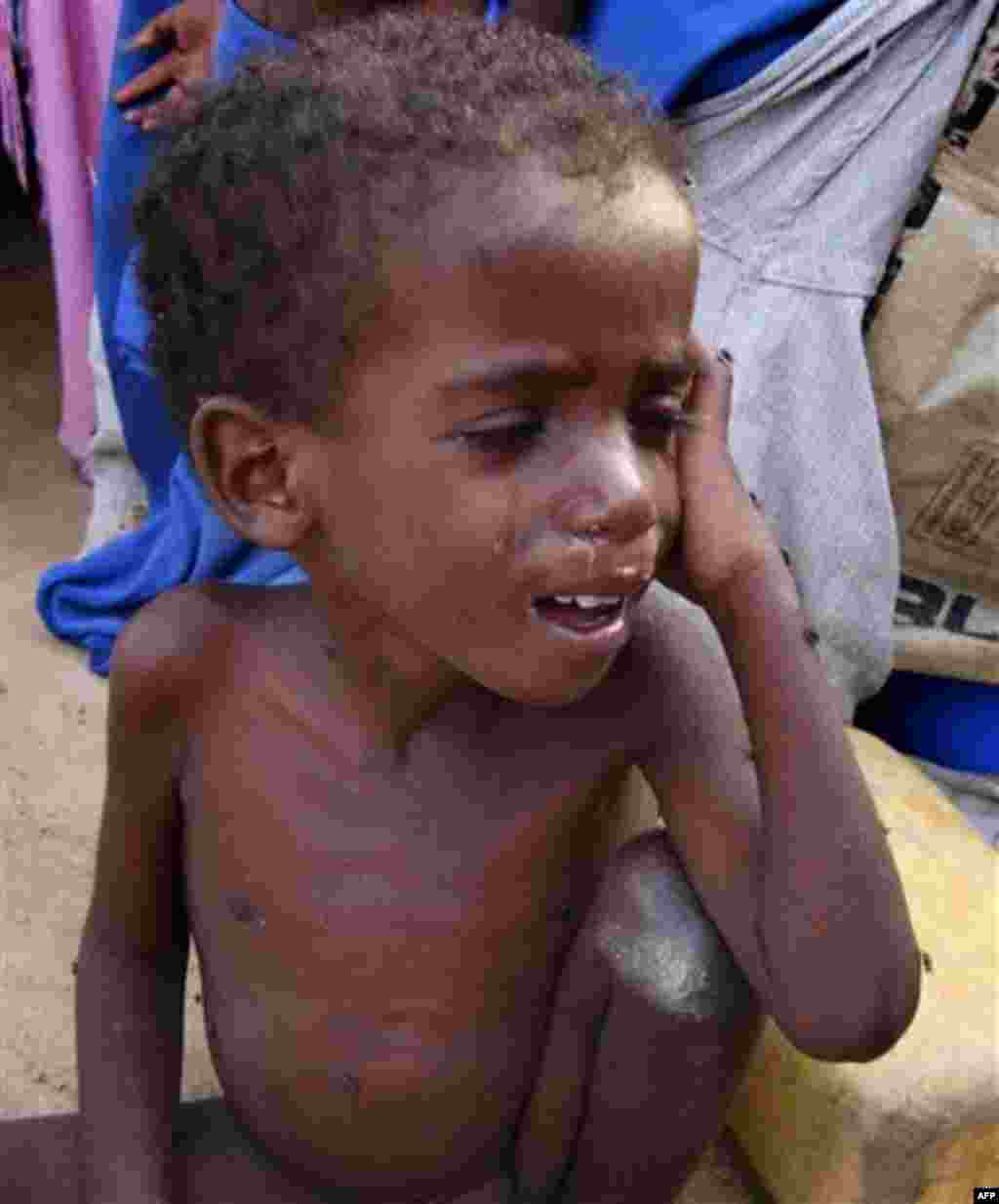 A malnourished child from from southern Somalia cries as he sits outside a makeshift shelter in a refugee camp in Mogadishu, Somalia, Monday, Aug. 15, 2011. The World Food Program said Saturday that it is expanding its food distribution efforts in famine-