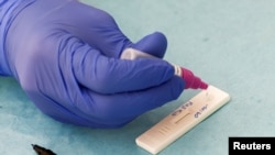 A medical staff member performs a rapid test