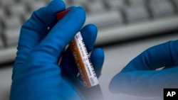 FILE - An employee of the Russia's national drug-testing laboratory holds a vial in Moscow, Russia. On Monday, July 18, 2016 WADA investigator Richard McLaren confirmed claims of state-run doping in Russia. 