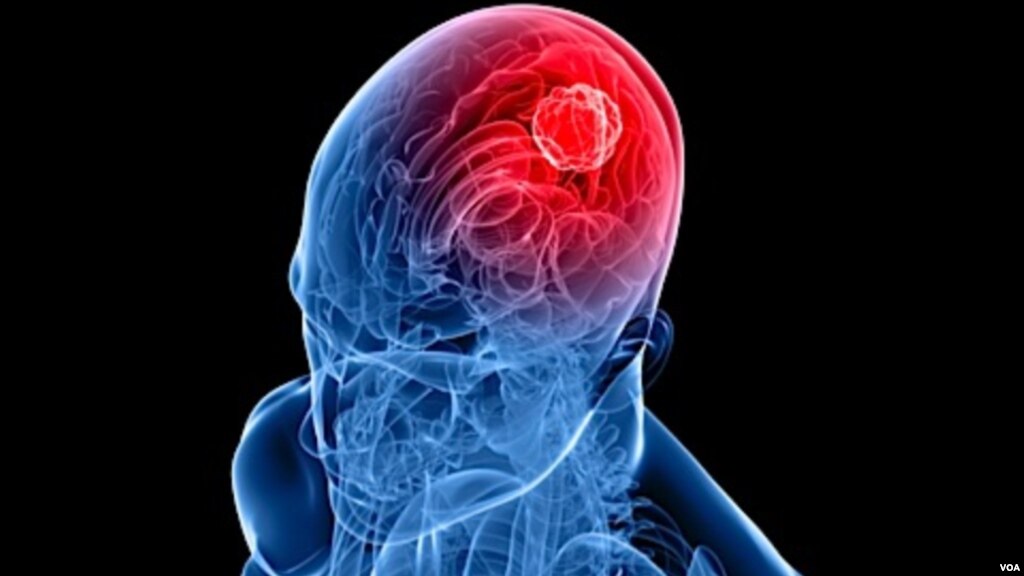 patient-s-fat-may-help-treat-brain-tumors