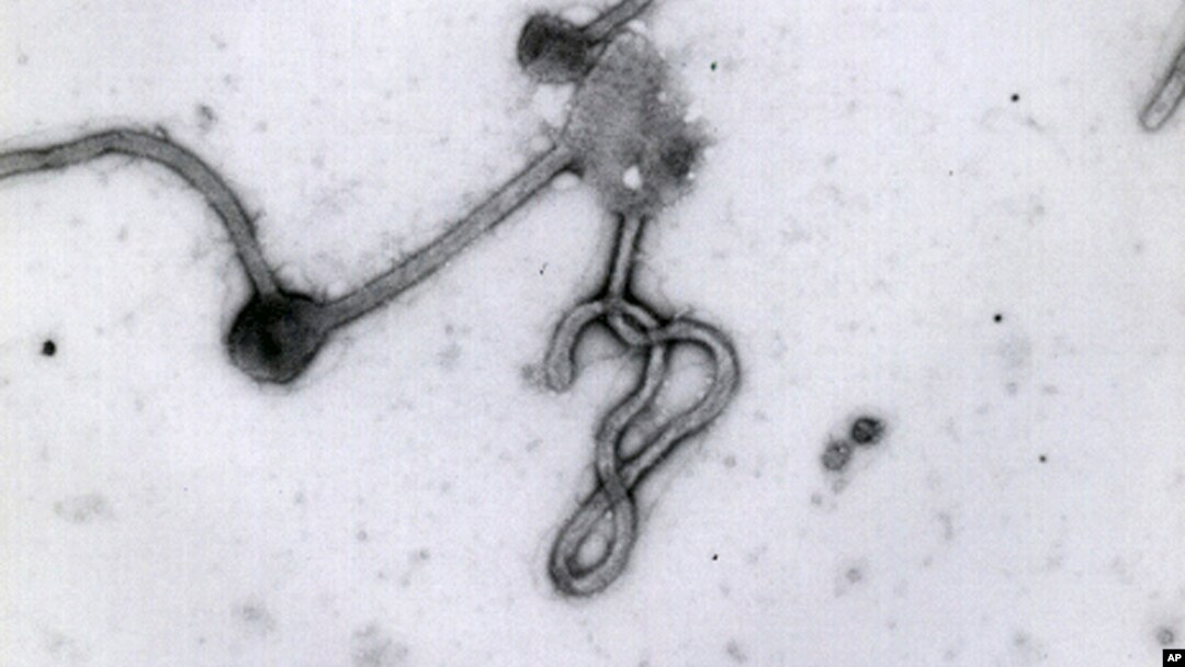 En la imagen, el virus del ébola visto al microscopio. 