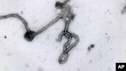 En la imagen, el virus del ébola visto al microscopio. 