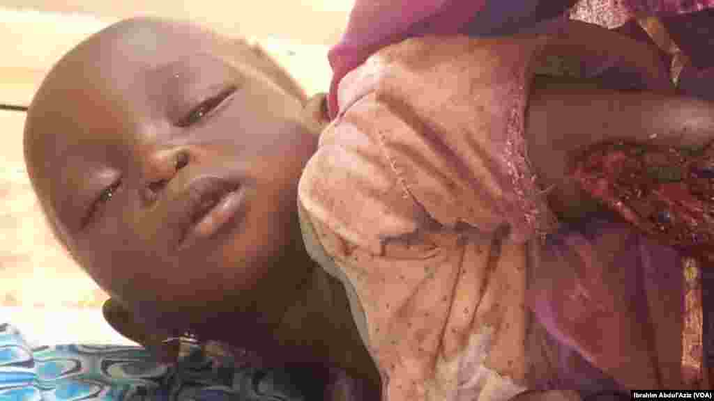 Wasu mutane da suka ji raunuka bayan harin 'yan bindiga da ake zaton Boko Haram ne a kauyen Chakawa ran 26 ga watan Junairu, 2014.