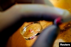 Seorang dokter di klinik fertilitas Alma Res, di Roma, menyiapkan sel telur dan sperma untuk inseminasi buatan, 7 Juni 2015. (Foto:Dok)