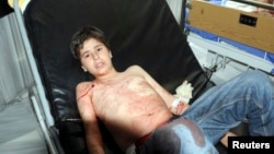 A boy who was injured after mortar bombs landed on two areas in Damascus is seen in a hospital, April 29, 2014.