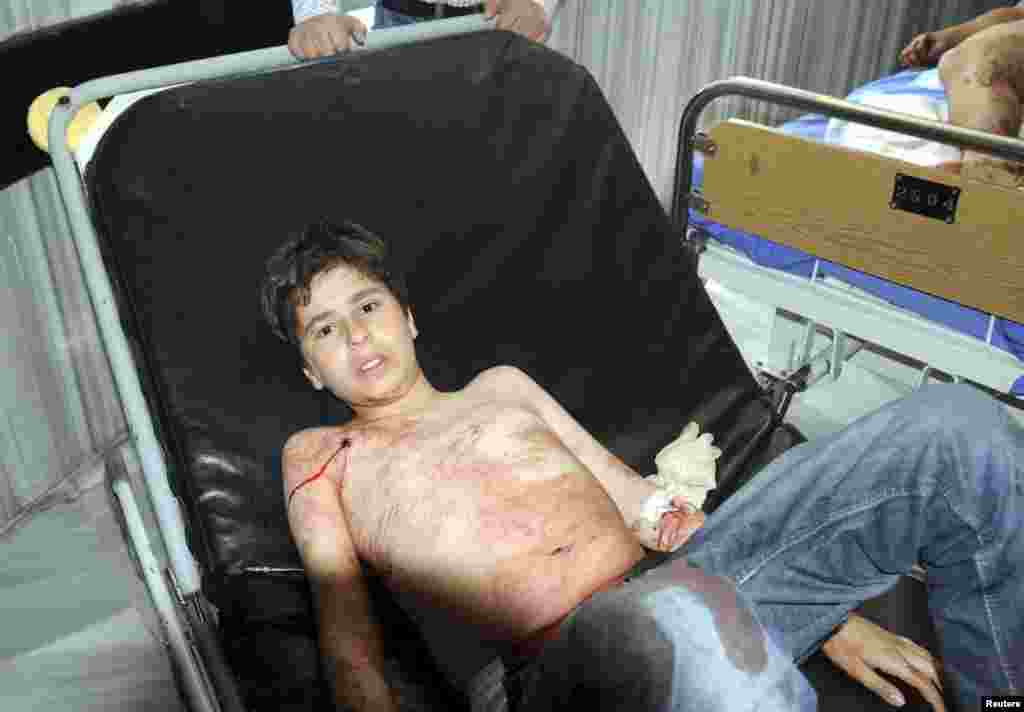 A boy who was injured after mortar bombs landed on two areas in Damascus is seen in a hospital, April 29, 2014.