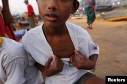 Nay Htet Lin, a 15-year-old worker, shows a heart-shaped tattoo on his chest of his mother's name at San Pya fish market in Yangon, Myanmar, Feb. 19, 2016.