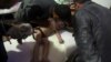 WHO: Puluhan Tewas, Ratusan Tunjukkan Gejala Terpapar Zat Kimia Beracun di Douma, Suriah