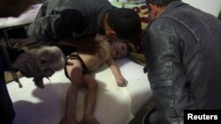 Seorang anak mendapatkan perawatan di rumah sakit Douma, Ghouta timur setelah terkena serangan yang diduga serangan senjata kimia, 7 April lalu. 