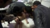 سازمان بهداشت جهانی: در ۵۰۰ بیمار سوری عوارض ناشی از حمله شیمایی دیده می شود