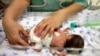 แพทย์ศึกษาวิธีช่วยเพิ่มโอกาสในการรอดชีวิตทารกคลอดก่อนกำหนด