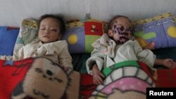 Anak-anak Korea Utara penderita malnutrisi yang parah, sedang dirawat di rumah sakit di Haeju, propinsi Hwanghae selatan (Foto: dok).