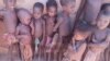 Crianças desnutridas no município do Curoca, província do Cunene, Angola. 