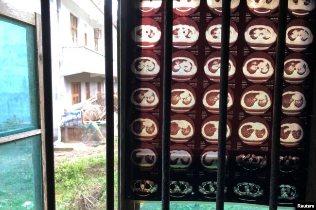 FILE - Negatives showing the lungs of Wang Zhaohong, who suffers from silicosis, hang on the window of Wang's room in Sangzhi county, Hunan province, China, Nov. 27, 2018.