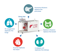 The perfusion machine replaces the functions of various organs in order to keep the donor liver alive outside of the body. (Image: University Hospital Zurich/beamue)