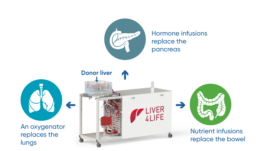 The perfusion machine replaces the functions of various organs in order to keep the donor liver alive outside of the body. (Image: University Hospital Zurich/beamue)