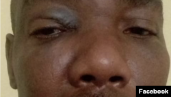 UMnu. Anglistone Sibanda