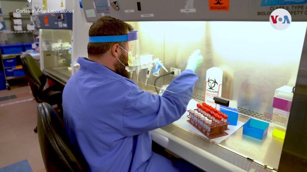 Masiva producción de kits de análisis para covid-19