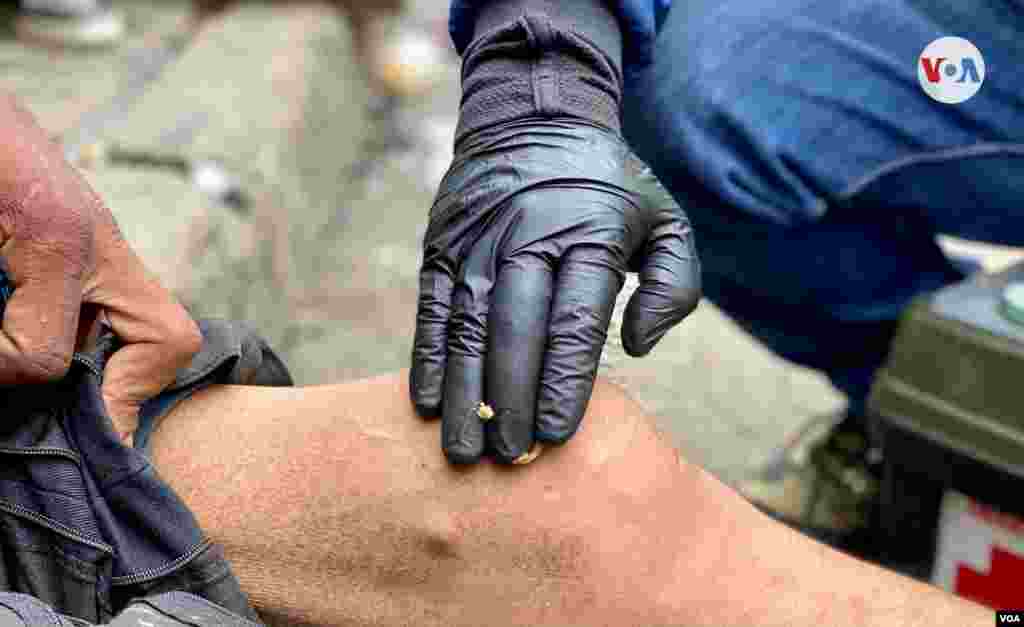 Este colombiano trata de aliviar sus dolencias con medicamentos, pomadas, bandas y elementos b&#225;sicos.