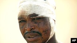 A victim of post election violence waits for treatment at St Gerrard's Catholic Hospital in Kaduna, Nigeria, April 20, 2011