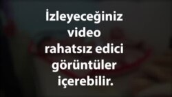 Yemen’de Açlık Krizi Büyüyor