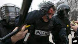 An injured policeman is helped by colleagues during a protest in Kosovo's capital Pristina, Jan. 27, 2015