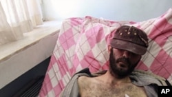 A fighter from the Free Syrian Army lies on a hospital bed in the southern town of Reyhanli in Hatay province on the Turkish-Syrian border, March 20, 2012.