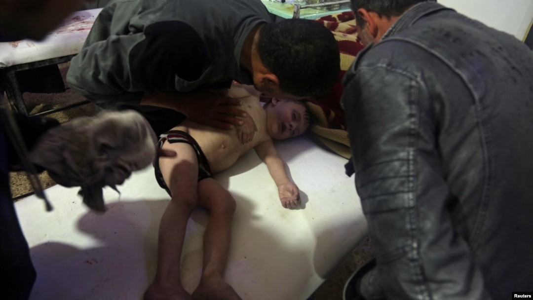 Seorang anak mendapatkan perawatan di rumah sakit Douma, Ghouta timur setelah terkena serangan yang diduga serangan senjata kimia, 7 April lalu. 