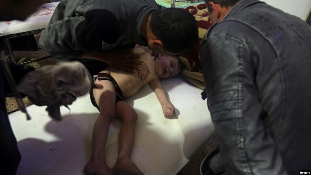 Seorang anak menerima perawatan di sebuah rumah sakit di Douma, bagian timur Ghouta, dekat Damaskus, Suriah, setelah serangan yang diduga menggunakan senjata kimia, 7 April 2018. (Helm Putih via Reuters) 