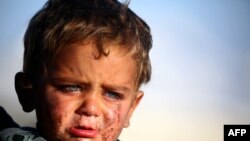 Un enfant pleure dans un camp temporaire de réfugies, village de Aïn Issa, Syrie, abritant les personnes ayant fui le groupe Etat islamique et Raqa, le 25 mars 2017. (AFP PHOTO / DELIL SOULEIMAN )