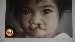 معذور بچوں کی زندگیاں بدلنے والی حشمت آفندی